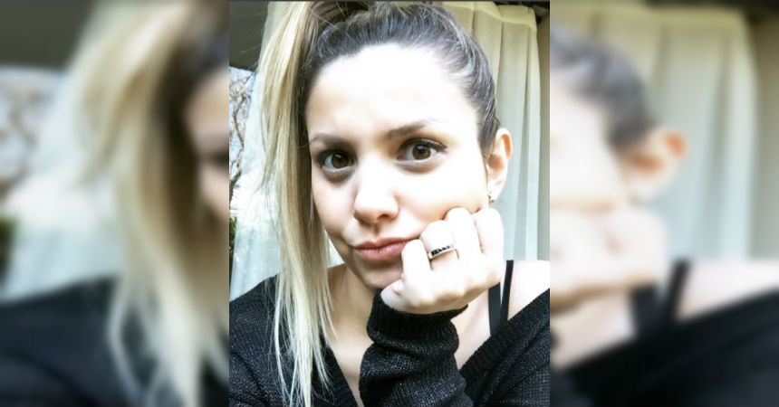 Nicole Pérez alopecia