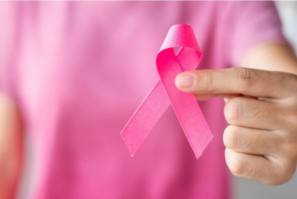 CÁNCER DE MAMA