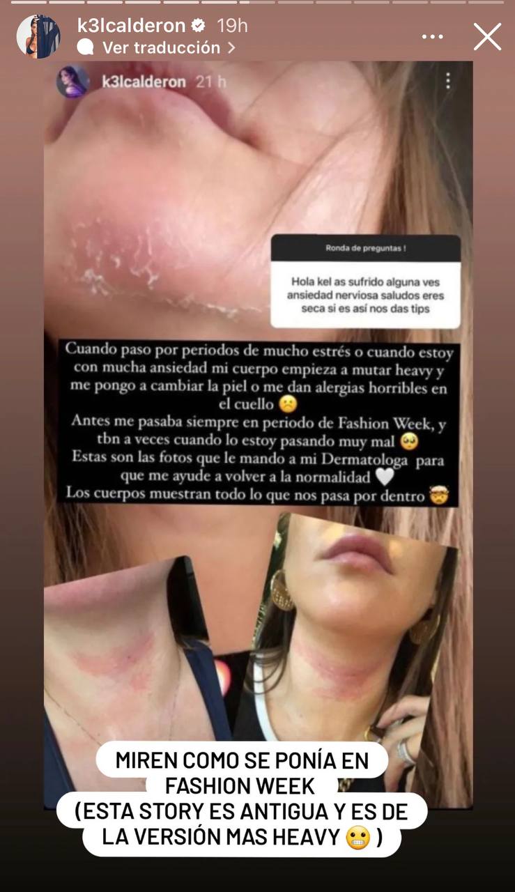 Kel Calderón Instagram