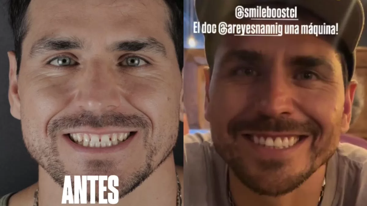 Procedimiento Pangal Andrade