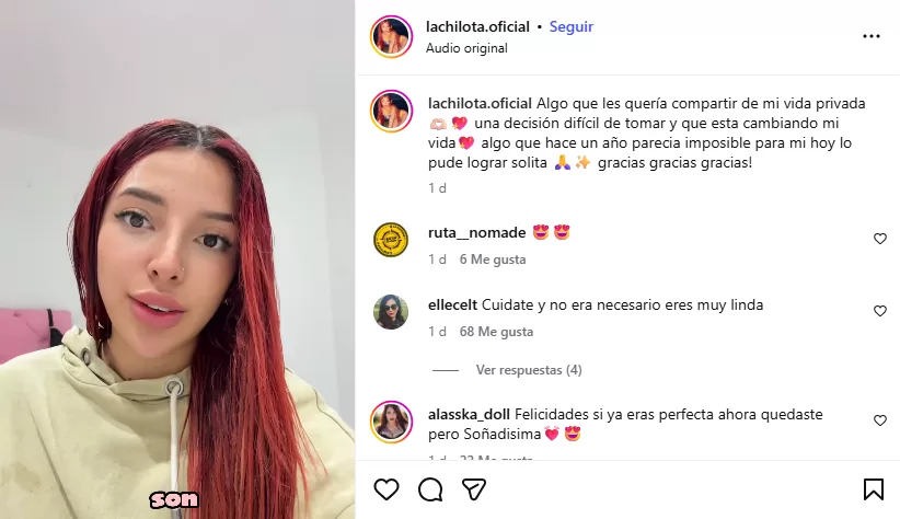 Publicación de la Chilota donde cuenta su proceso de cirugía