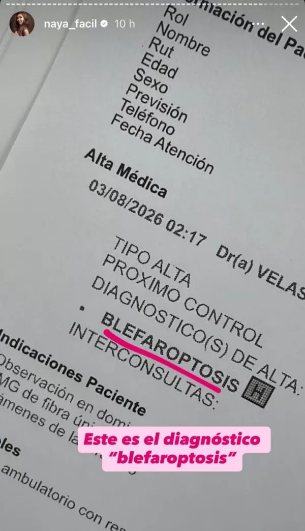 Naya Facil
